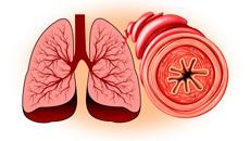 Атопическая бронхиальная астма